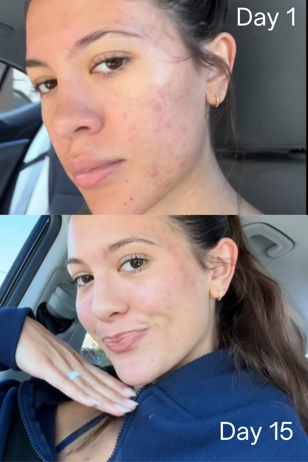 Notox Notox Skin Lab - Notox 1.1 - Advanced Anti-Aging Serum Skincare Daily